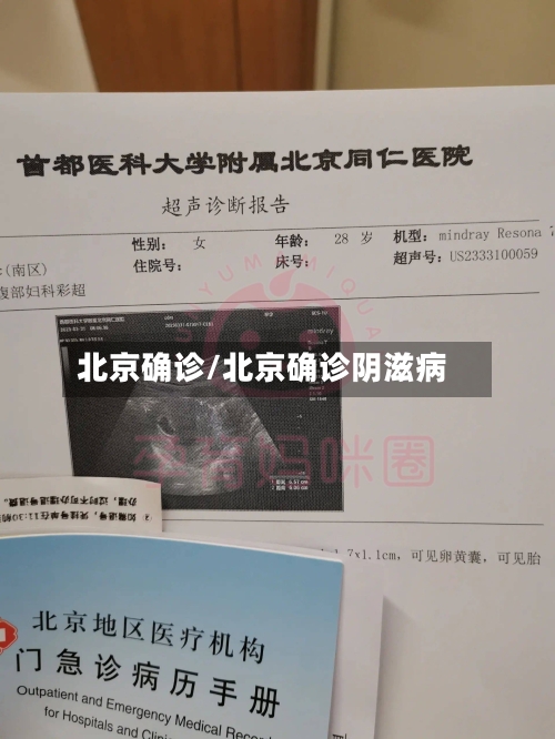 北京确诊/北京确诊阴滋病